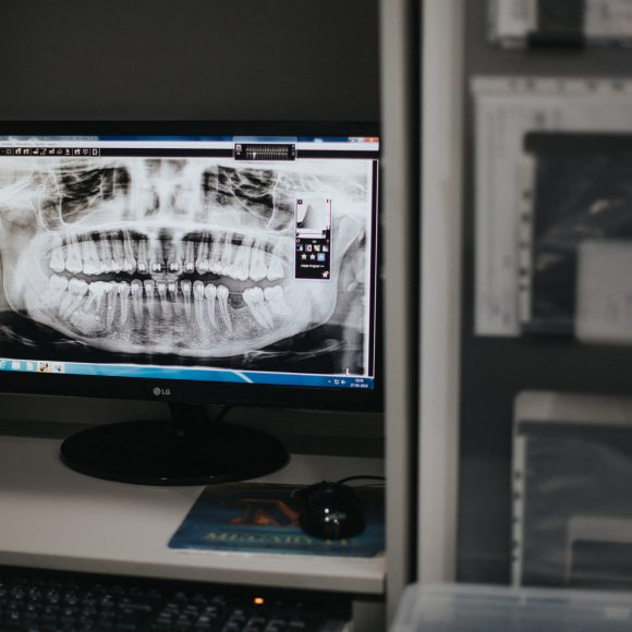 TAC 3D, Radiografia Digital Panorâmica e Teleradiografia TAC 3D, Radiografia Digital Panorâmica e Teleradiografia